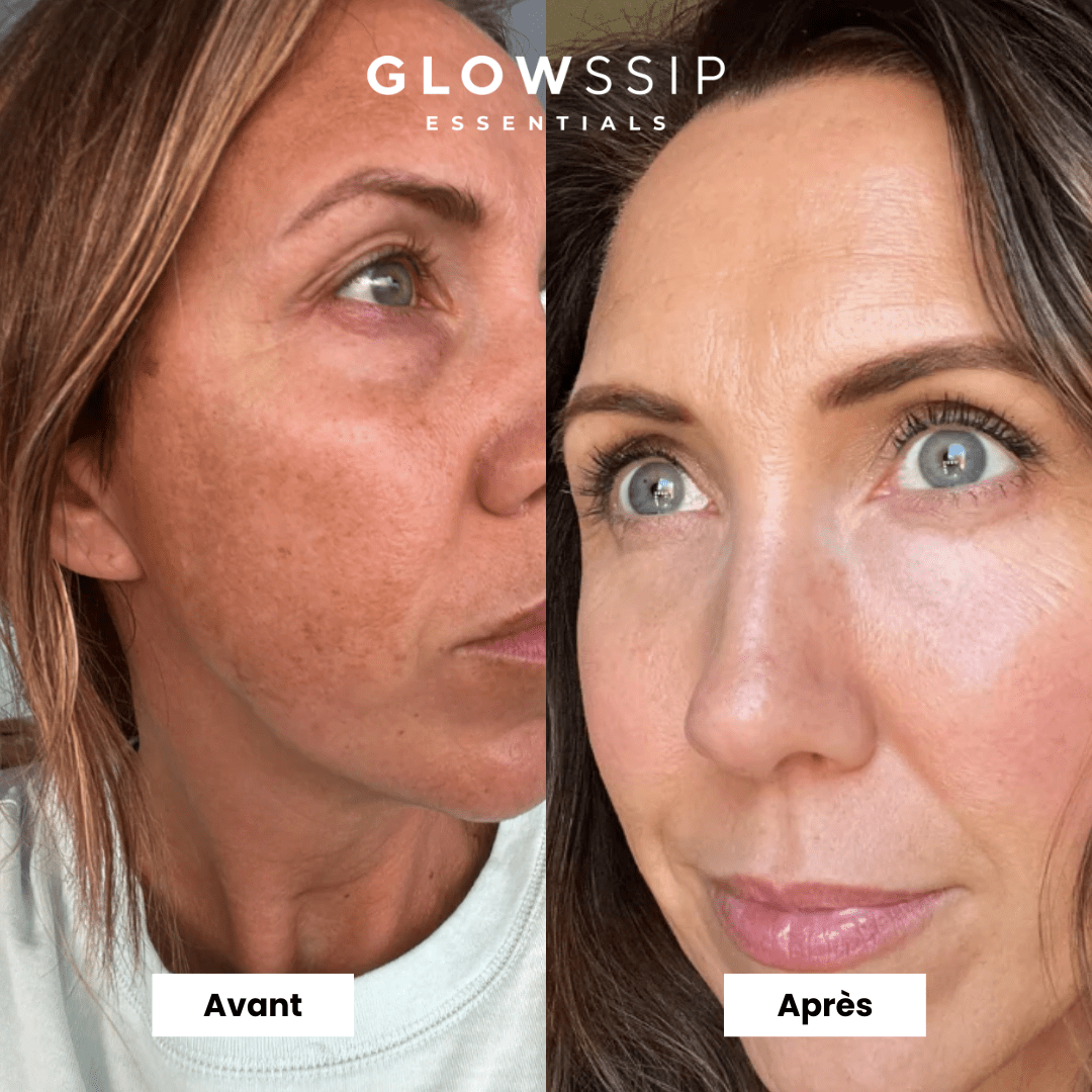 Masque Hydrogel PDRN®