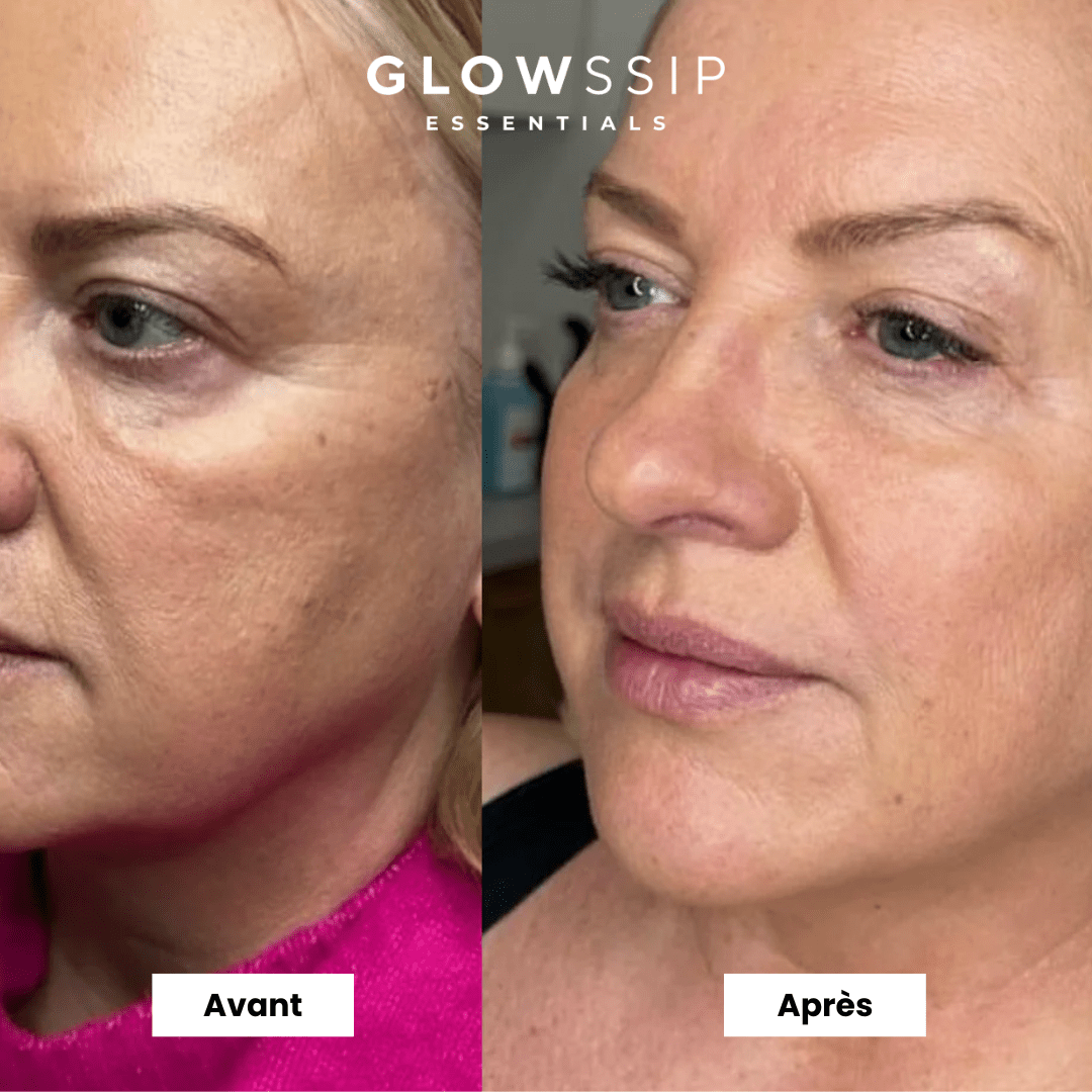 Masque Hydrogel PDRN®