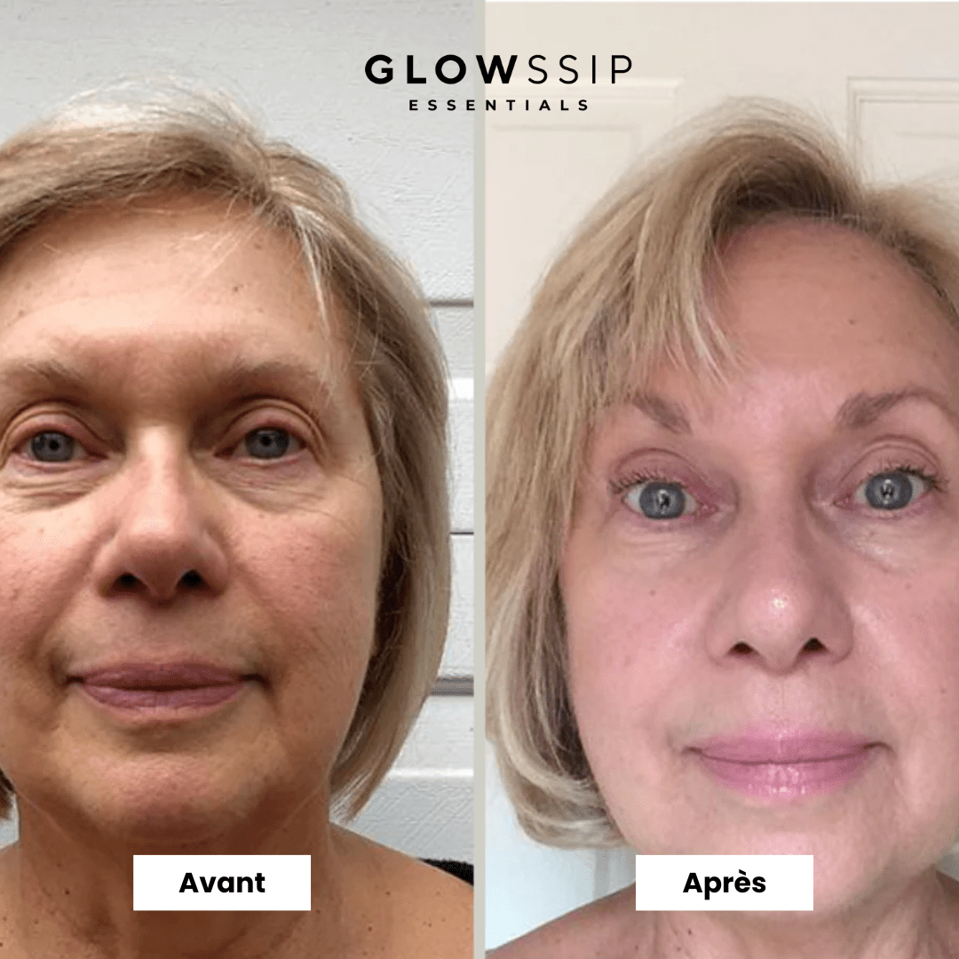 Masque Hydrogel PDRN®