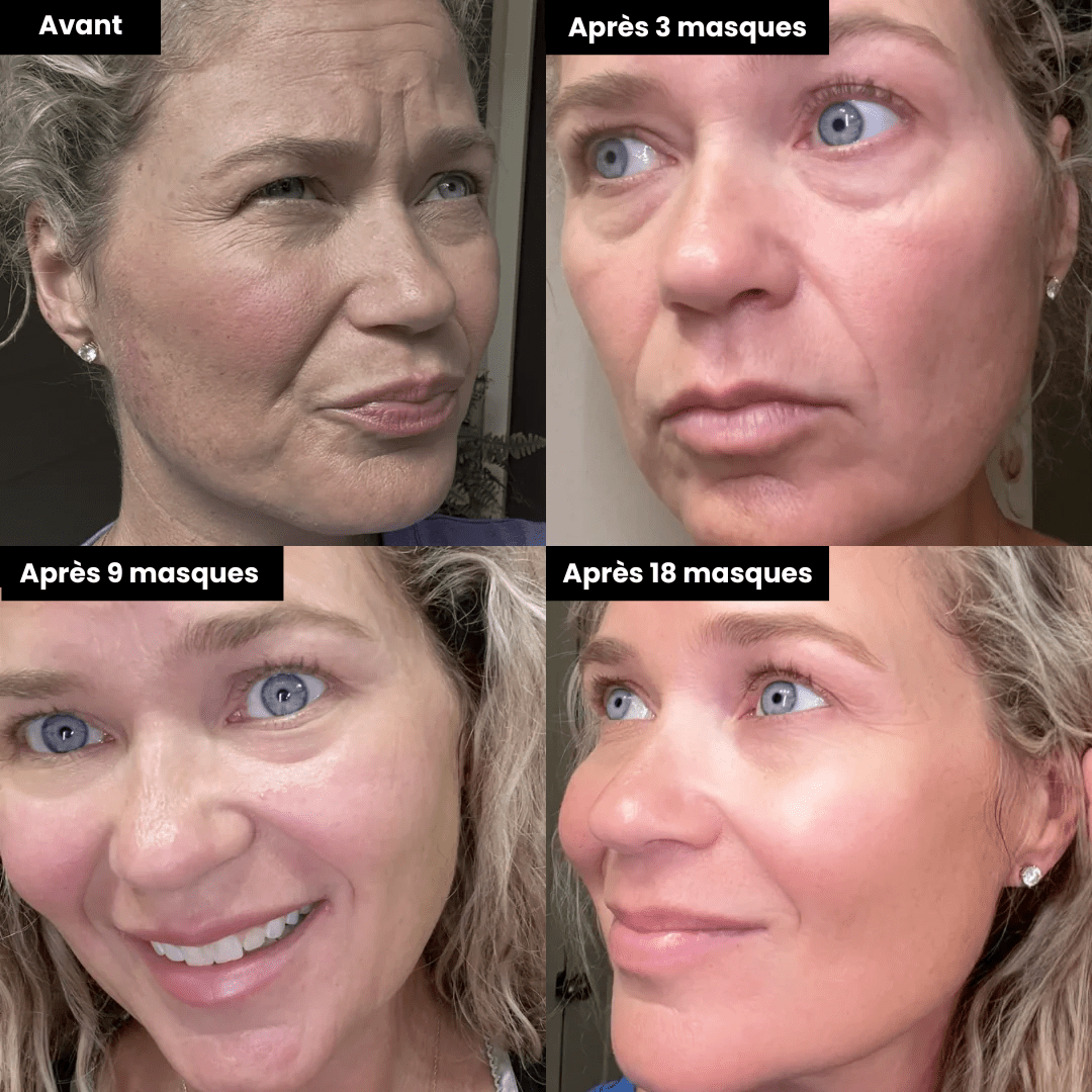 Masque Hydrogel PDRN®