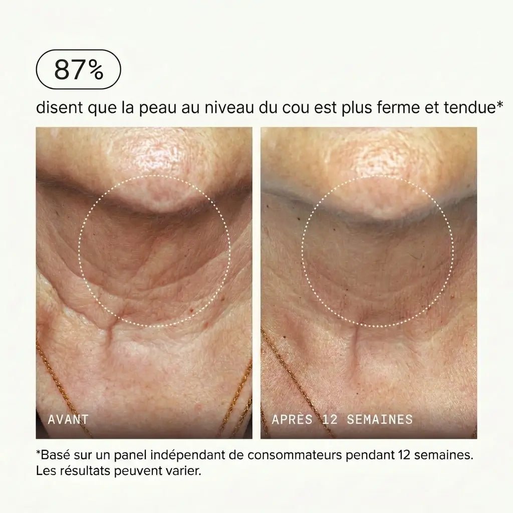 Micro-Infusion Sérum PDRN™