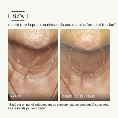 Micro-Infusion Sérum PDRN™